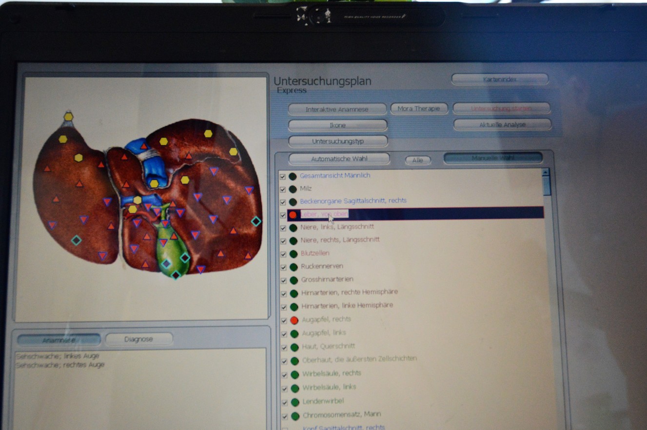 Delta_scan_Bioresonanz_leber_vor_behandlung